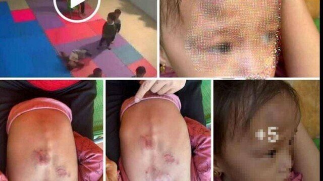 Thời gian qua xảy ra nhiều vụ trẻ bị bạo hành (ảnh minh họa)